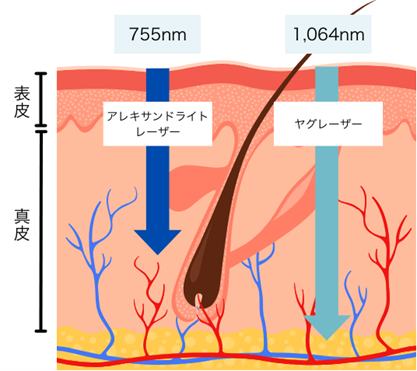 ２つの波長を搭載