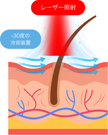 痛みも軽減