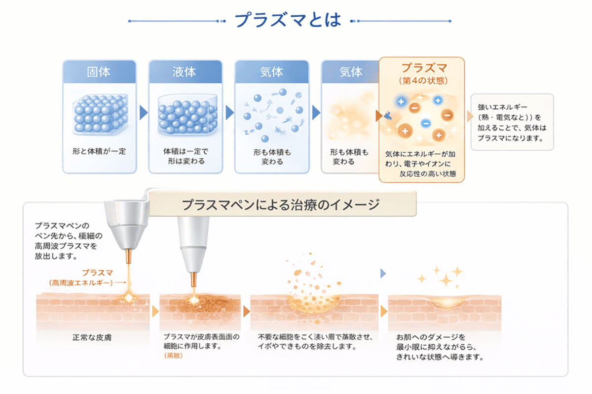 プラズマペンによる治療のイメージ